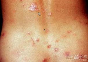 吃瓜梅毒女孩,一场网络暴力的反思