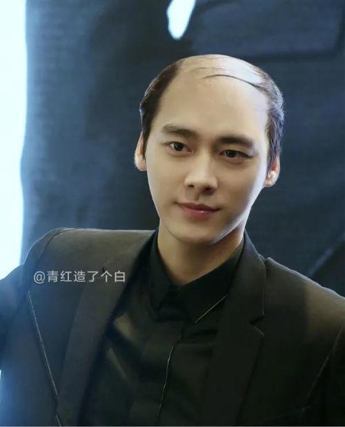 明星头发秃头,揭秘明星脱发背后的故事